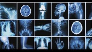 What You Need to Know Before You Get an X-ray