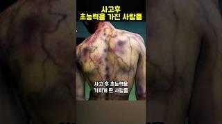 사고 후 초능력을 가지게 된 사람들 TOP 3