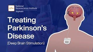 Parkinson's Disease Treatment Options! | Deep Brain Stimulation (DBS) Explained!