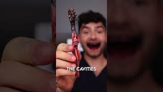 Cursed Candies vs Cavities !?