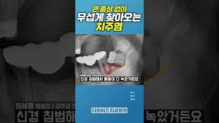 치주염 방치하면 신경까지 손상된다고? #임플란트 #치과의사 #dentist