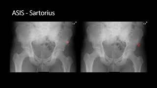 Pelvis & Hip  Part 2