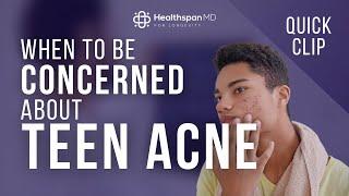 When to be concerned about teen acne