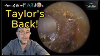 Taylor's Back! 141 #ear #earwax #earwaxremoval #earcleaning #earwaxclinic #earwaxextraction