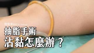 【抽脂手術】緊身衣勒痕造成沾黏？｜#陳煥棠教授 Dr. Samuel｜#金貞醫學美容