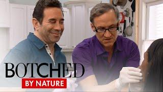 Botched by Nature | "Botched By Nature" Docs Tackle "Risky" Venous Malformation | E!