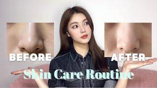 Daily Skincare Routines (for normal/combination/sensitive skin, pore, sebum, acne...)