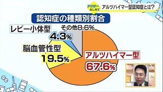 アルツハイマー型認知症とは？（ドクターおしえて）