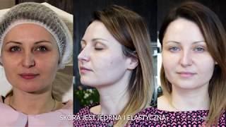 Uroda bez tabu - terapia anti-aging dla skóry 30+