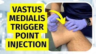 Trigger Point Injection Vastus Medialis Oblique (VMO) Technique