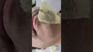 충격 쾌감! 수염왁싱 face hair removal beard waxing #shorts