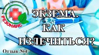 Как избавиться от экземы? Как я вылечил экзему. Экзема лечится! Клиника «Резонанс». Отзыв №4