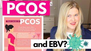 TRUE CAUSE OF PCOS | A Fertility Doctor Reacts to the Medical Medium: What Causes PCOS?