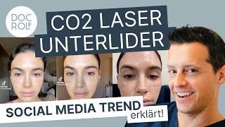 CO2 LASER für STRAFFE UNTERLIDER, funktioniert das?! Dr. Rolf Bartsch