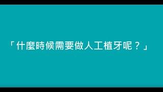 Dr. Wells牙科知識分享＿什麼時候需要做人工植牙呢？高宇鋒醫師主講