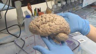 Families donate brains to help autism research