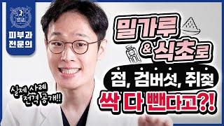 집에서 밀가루 식초로 점, 검버섯, 쥐젖 한번에 쏙 빼는 법 | 생생한 실제 경험담, 후기, 놀라운 효과까지 솔직하게 공개합니다! | 점제거 검버섯제거 쥐젖제거