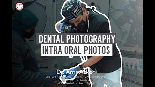 dental photography in relation to orthodontics part II intra oral photographs