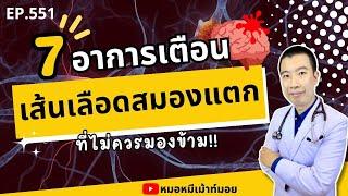 7 อาการเตือนเส้นเลือดในสมองแตก คน 90% ไม่รู้ | เม้าท์กับหมอหมี EP.551