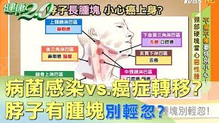 病菌感染vs.癌症轉移？ 脖子有腫塊別輕忽？ 健康2.0