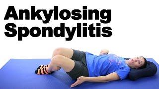 Ankylosing Spondylitis Stretches & Exercises - Ask Doctor Jo