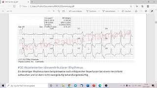 Wir befunden live EKGs (20.00 Uhr)