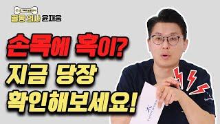 손목에서 말캉말캉한 혹이 만져지는 ‘손목 결절종’ 어떻게 치료할까? - 골통 의사 윤재웅 #65 결절종