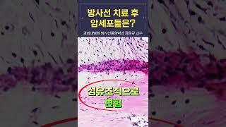 방사선 치료 후 암세포들은 어떻게 될까? [경희대병원 방사선종양학과 공문규 교수] | #shorts #폐암 #방사선치료 #암세포 #섬유화