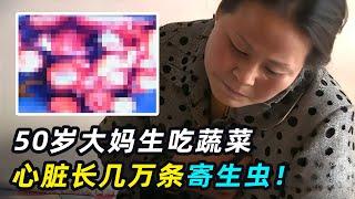 大妈喜爱生吃蔬菜，心脏长一串“葡萄”，医生切出上万寄生虫