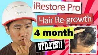 iRestore Pro Laser Hair Growth Helmet Review Ep. 3: 4-month Update!