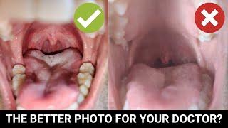 send a photo of your throat to your doctor