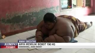 Awal Mula Arya Alami Obesitas