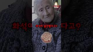 91세 할머니 뱃속에 있던 ‘태아 화석’