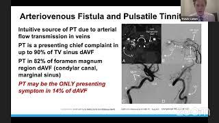 Mount Sinai Neurosurgery TeleRounds