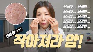 피부과의사의 필살 모공작게 만드는 법!!!
