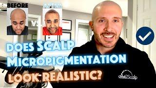 Does Scalp Micropigmentation look REAL ?