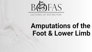 Amputations of the Foot & Lower Limb - BOFAS Lectures of Distinction