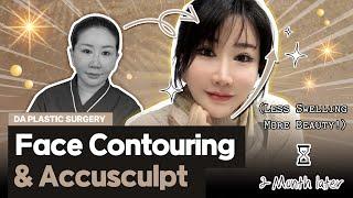 [Plastic Surgery Korea] Best Revision Face Contouring Results You can Get! DA Plastic Surgery