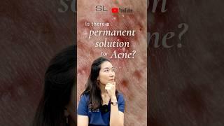 Can acne be healed permanently? #doctor #shorts #acne #acnetreatment #cysticacnestory #blackheads