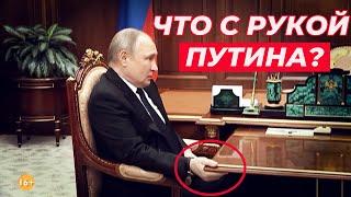 Что СЛУЧИЛОСЬ с правой рукой путина?