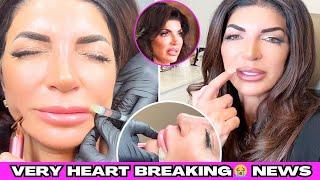 HeartbreakingNews : Real Housewives Teresa Giudice Undoes 'Hot Dog Lips' with Lip Filler Dissolve!