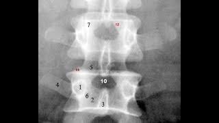 Radiological Anatomy of the Lumbar Spine: X-ray, MRI & CT Covered