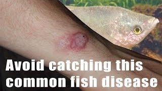 How to identify and avoid catching fish TB, Tuberculosis Mycobacterium marinum