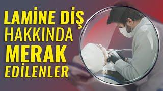 Lamine Diş Hakkında Merak Ettiklerinizi Sizler İçin Cevapladık