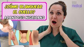 ¿Cómo BLANQUEAR EL CUELLO? ‍️ /Dra. Melissa Tejeida