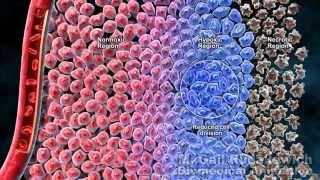 Cytotoxic Chemotherapy