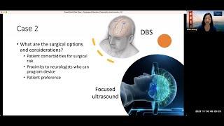 Surgical Treatment Options for Movement Disorders | UCSF Neurosurgery Community Grand Rounds