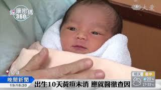 嬰兒黃疸"10"天未退 應主動就醫