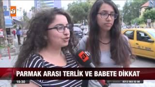 Parmak arası terlik ve babete dikkat - atv Ana Haber