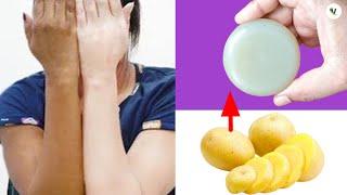 Perfect Potato Soap Making At Home || instant skin whitening & brightening homemade soap.